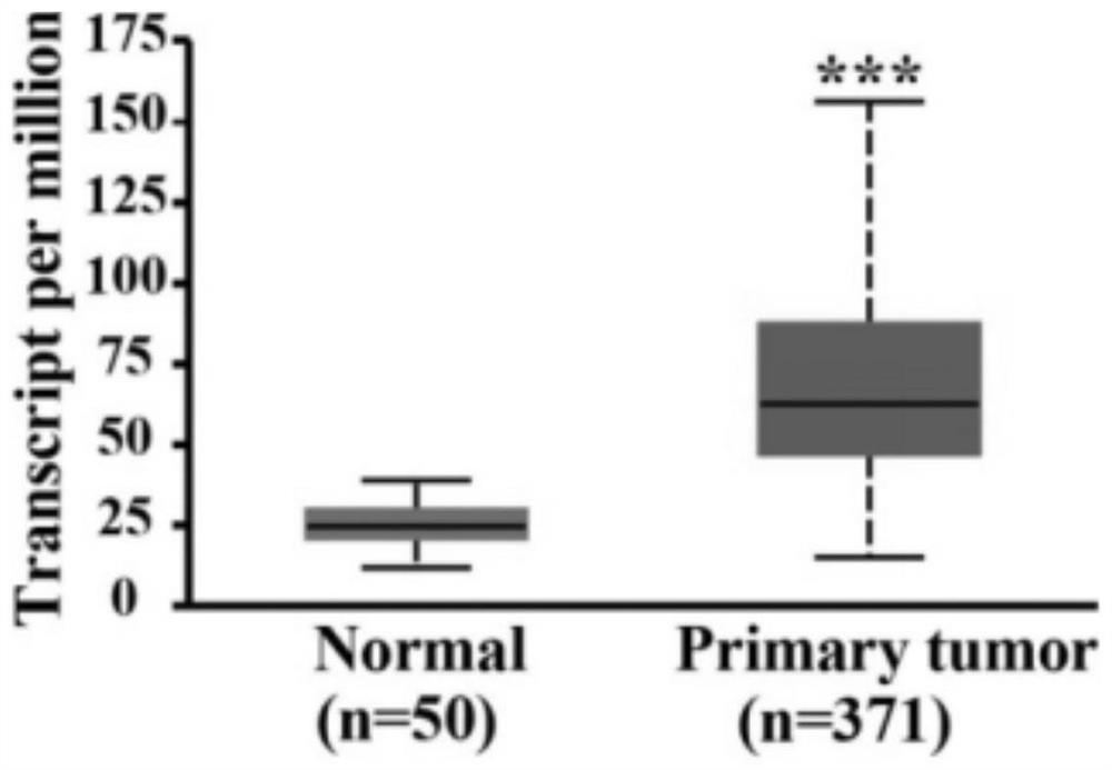 Sorafenib drug-resistant marker and application thereof