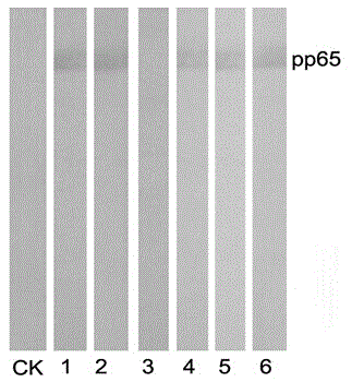 Preparation method and application of anti-HCMV (human cytomegalovirus) Pp65 protein monoclonal antibody