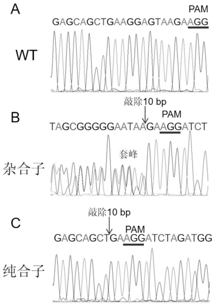 Human tumor xenotransplantation model construction method and application thereof