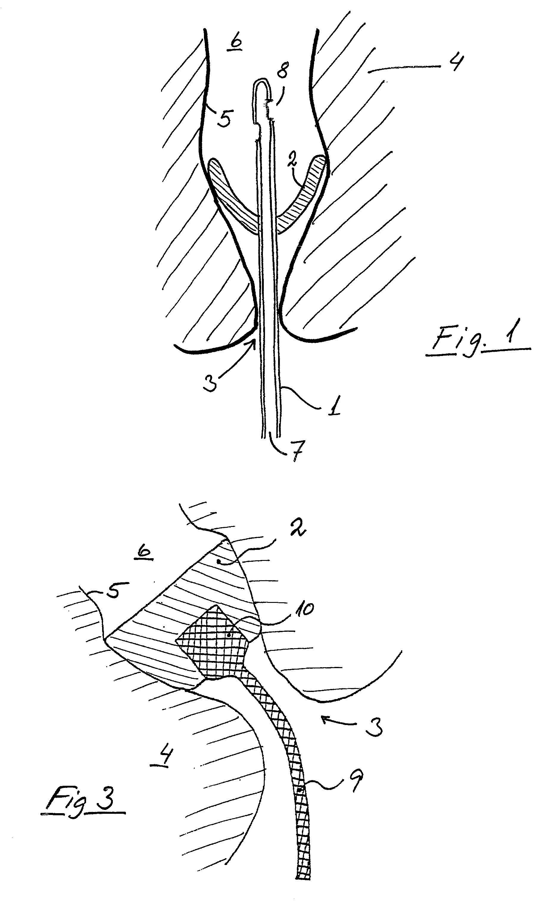 Sealing device