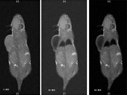 Novel tumor targeting contrast agent