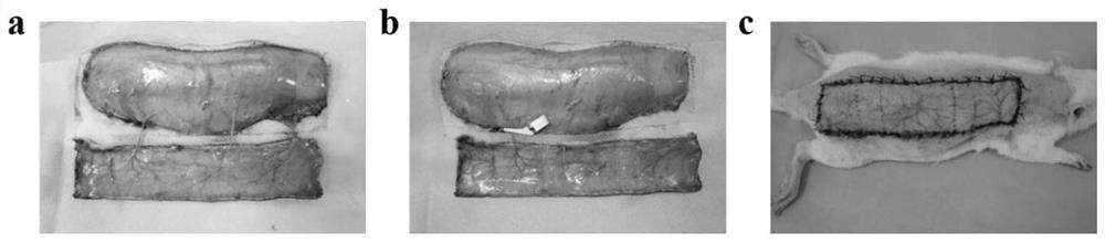 Multifunctional hydrogel for promoting blood circulation long-acting opening and preparation method thereof