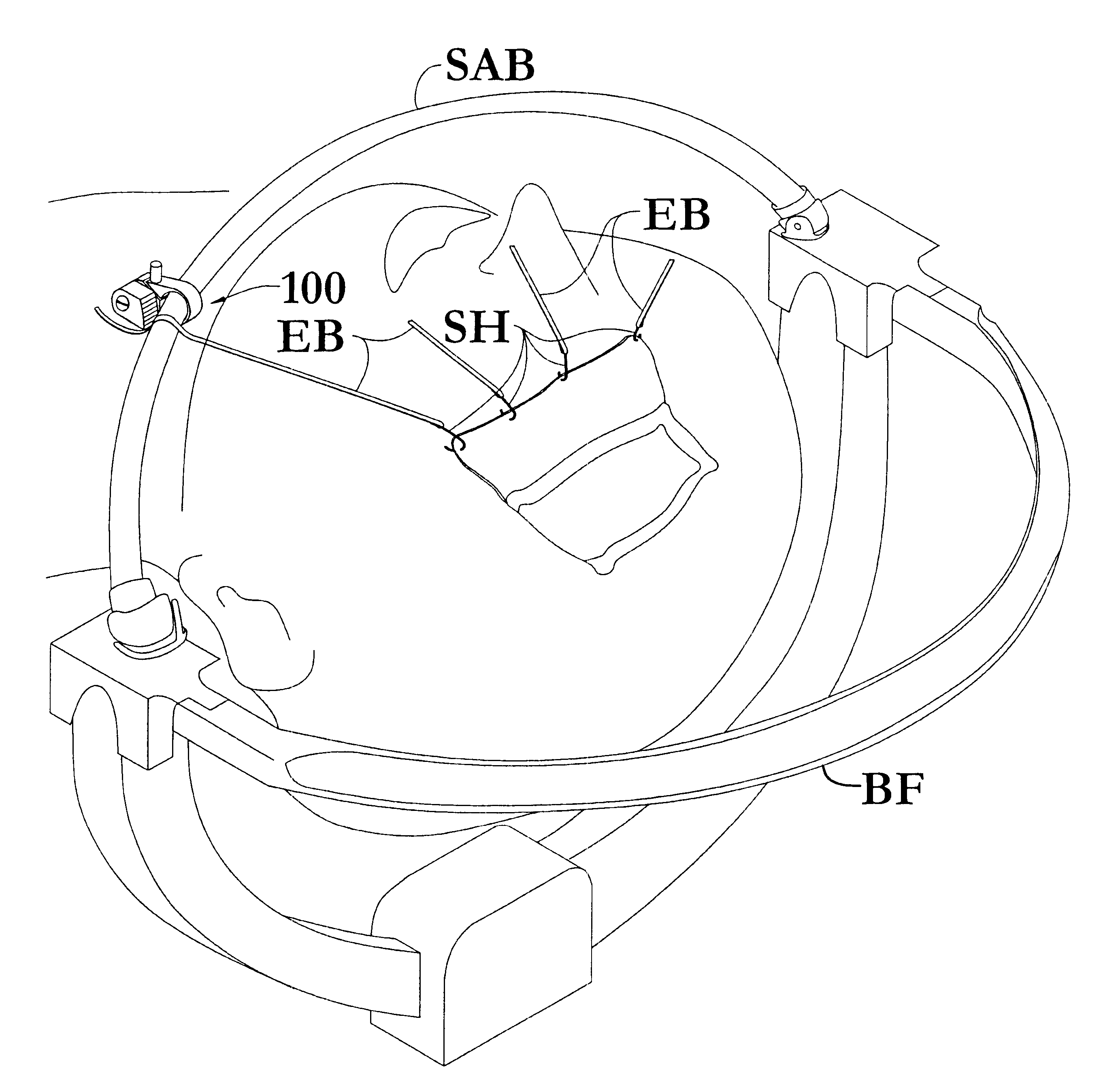 Surgical retractor securing apparatus