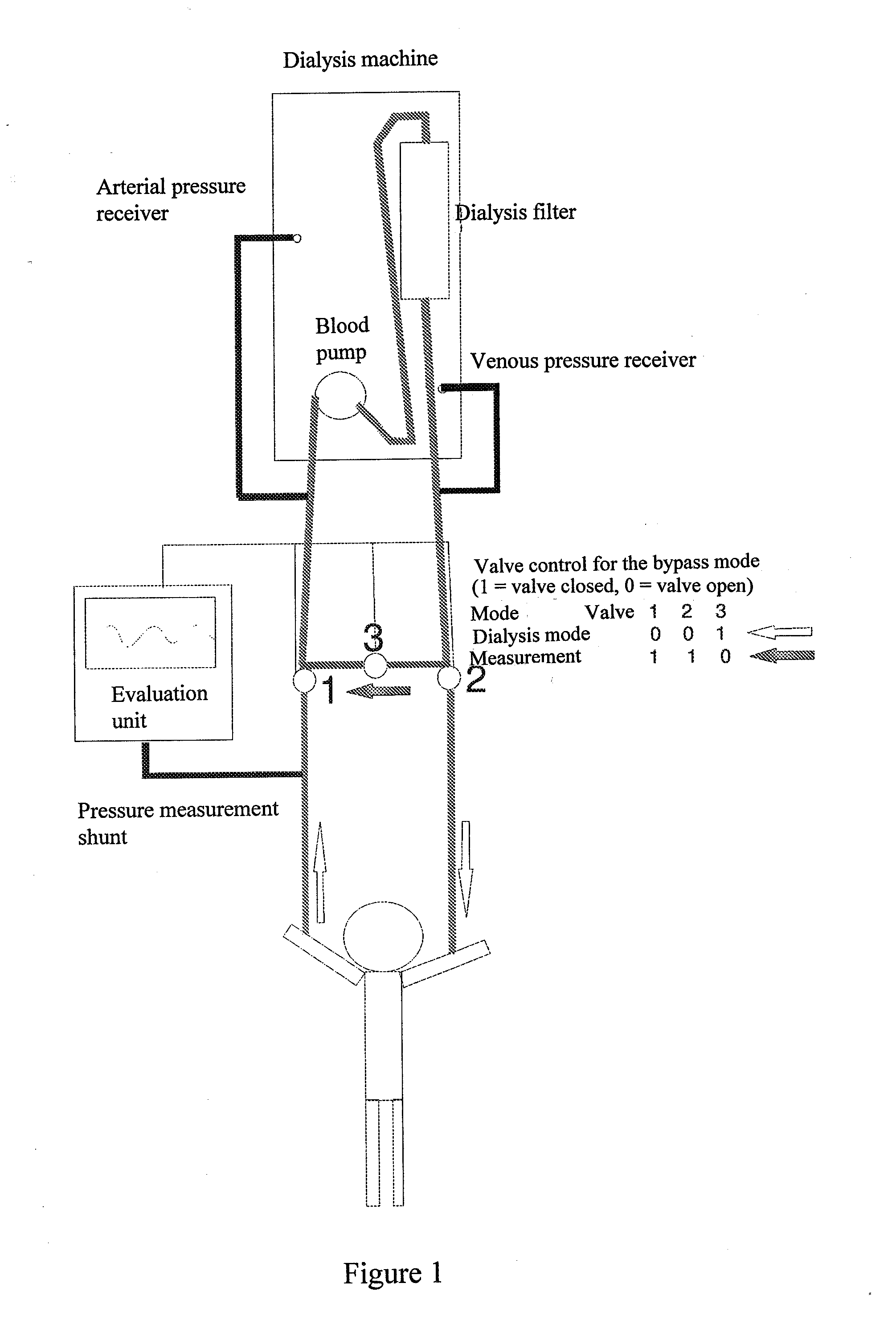 Method and device for invasive blood pressure measurement in a vascular access