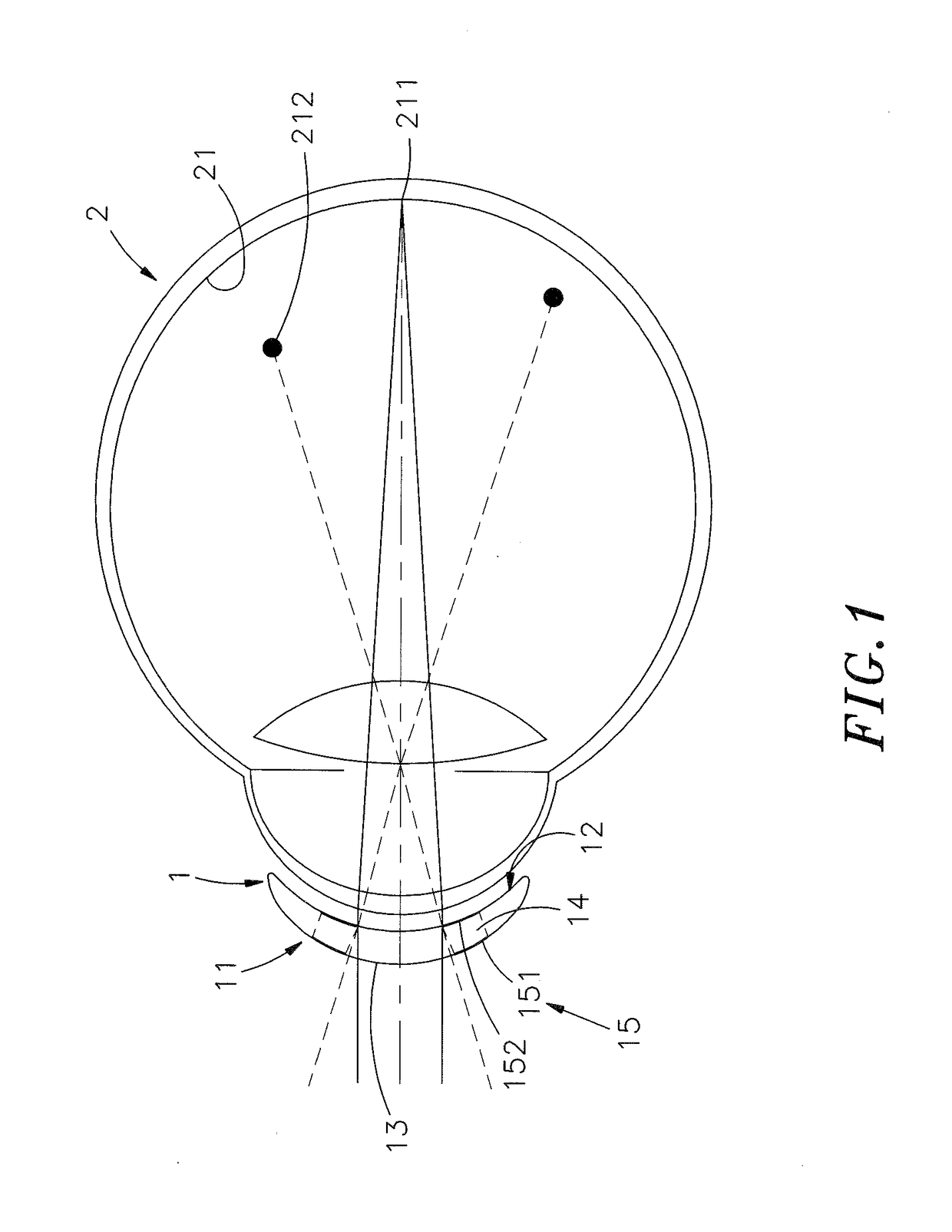 Contact lens having a moiré structure, contact lens moiré structure processing method