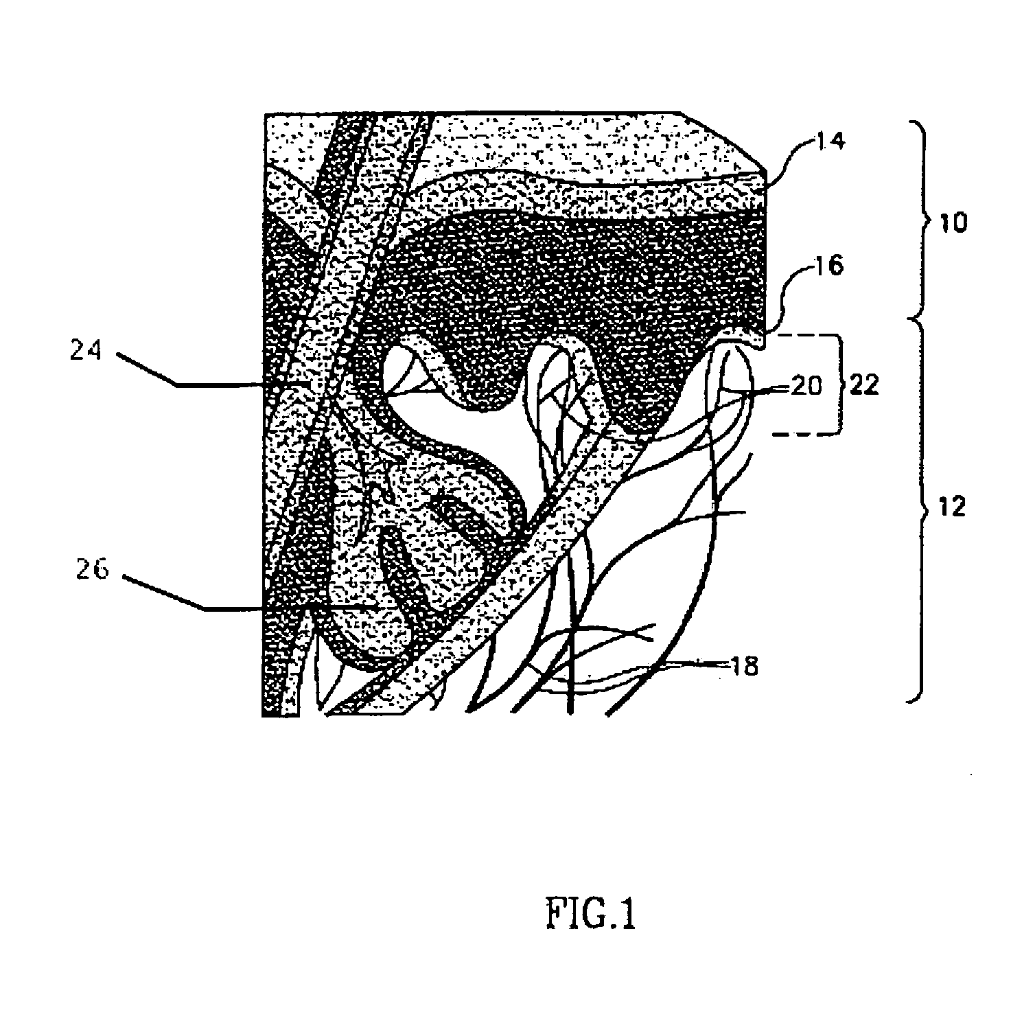 Method of treating erythematous papules