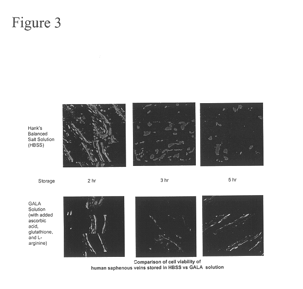 Composition and methods for tissue preservation