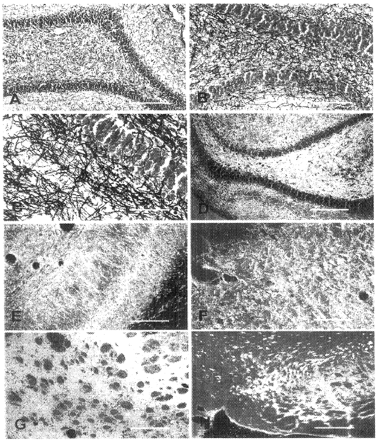 Histochemical labeling stain for myelin in brain tissue