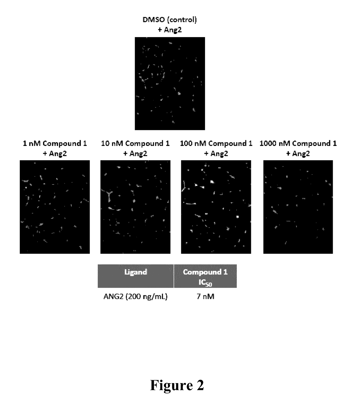 Inhibition of tumor cell interactions with the microenvironment resulting in a reduction in tumor growth and disease progression