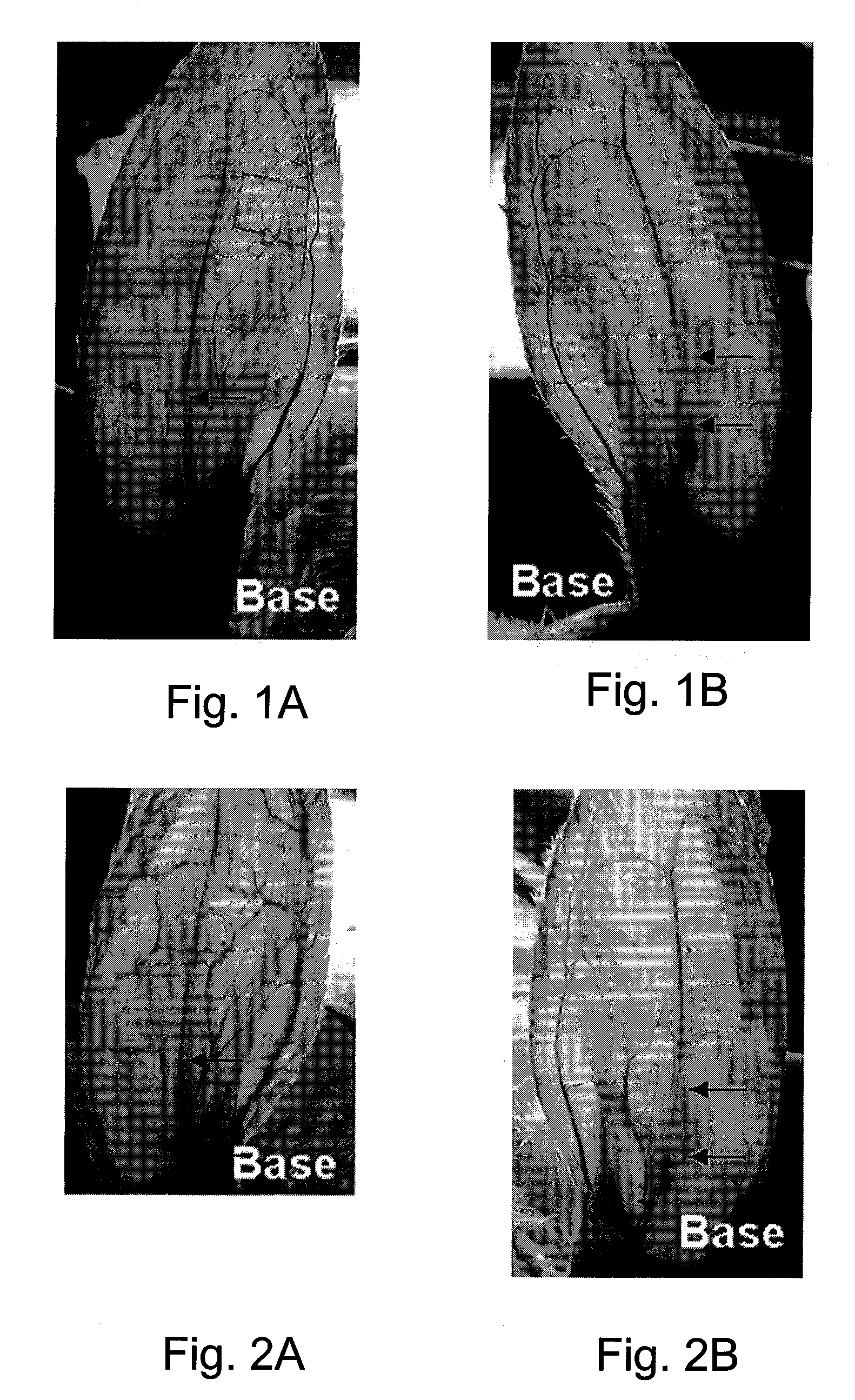 Prostaglandin compositions and methods for the treatment of vasospasm