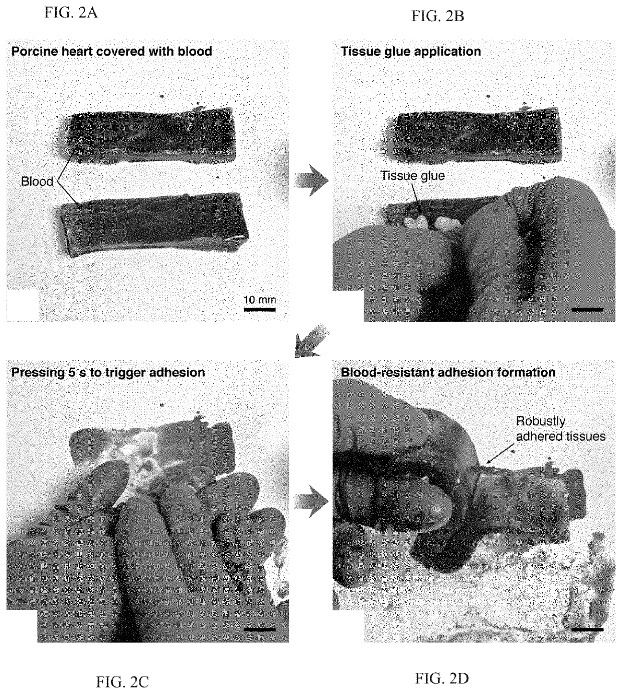 Body fluid resistant tissue adhesives