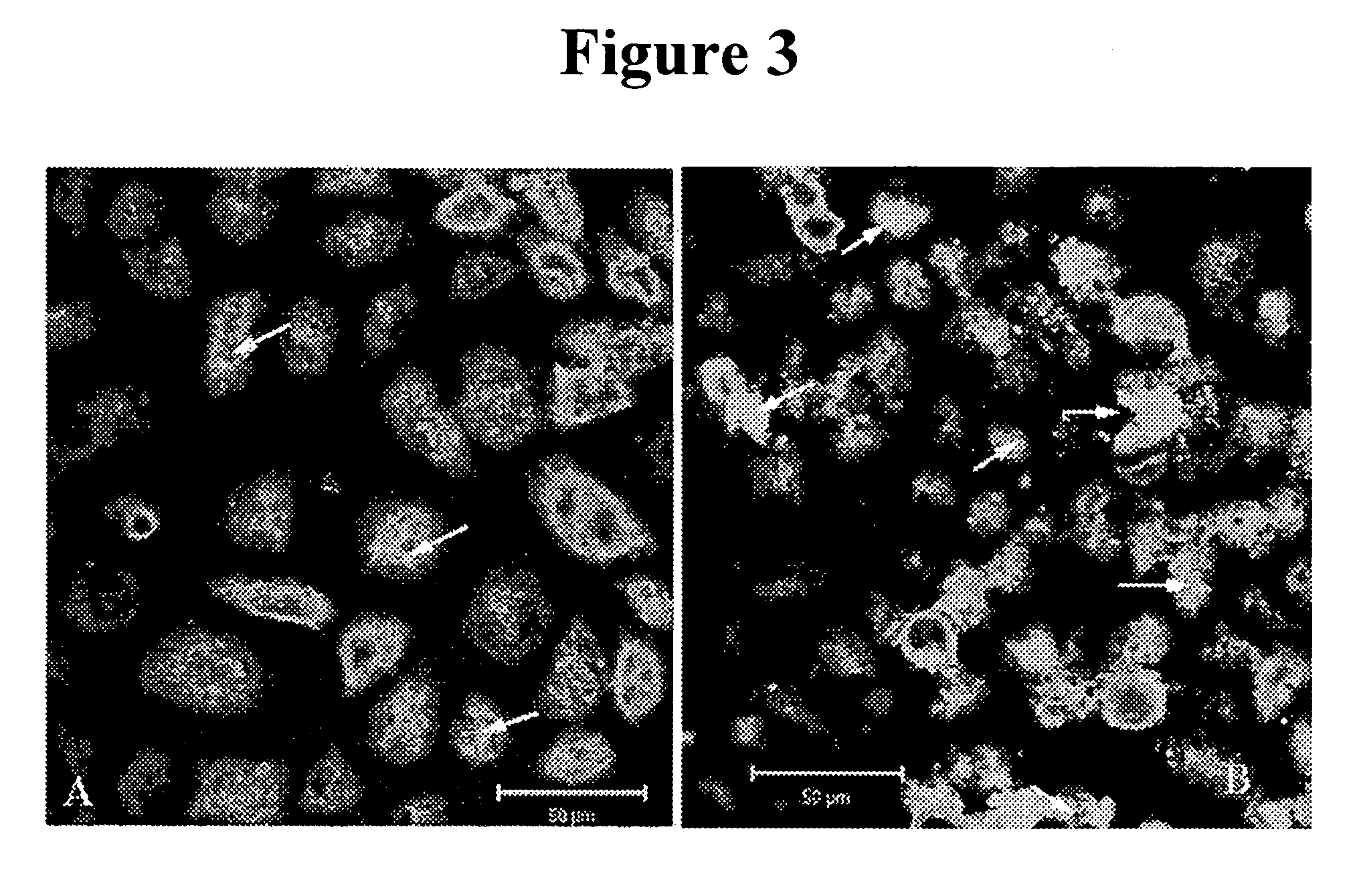 Vitamin E tocotrienols inhibition of intracellularly obligate pathogen Chlamydia and methods of use