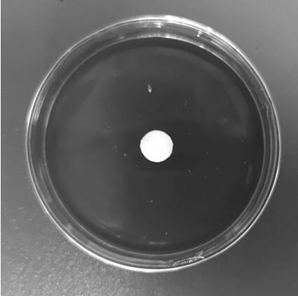 AB glue for intraoperative bleeding arresting of bone surgery