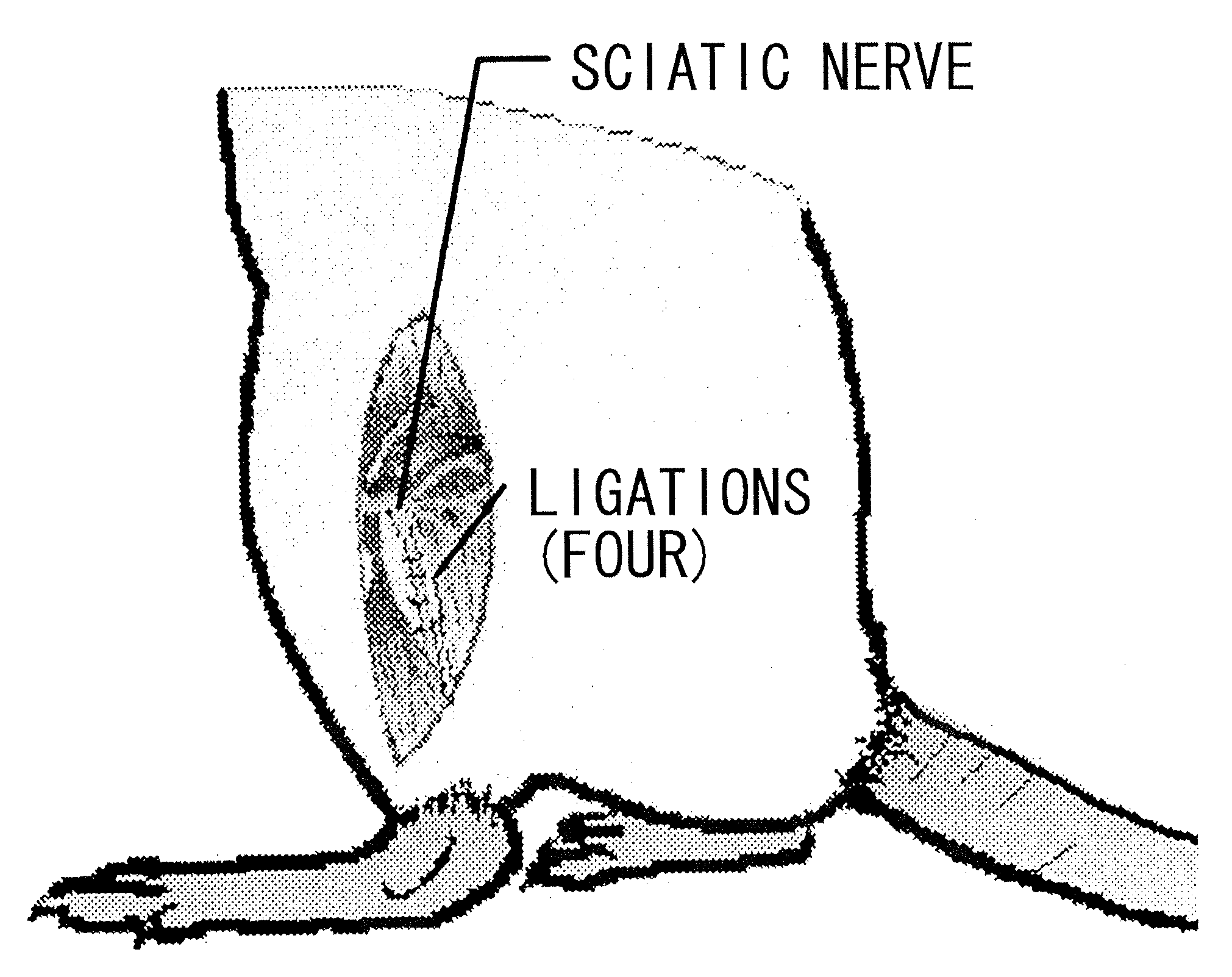 Therapeutic Agent for Sensory Abnormality