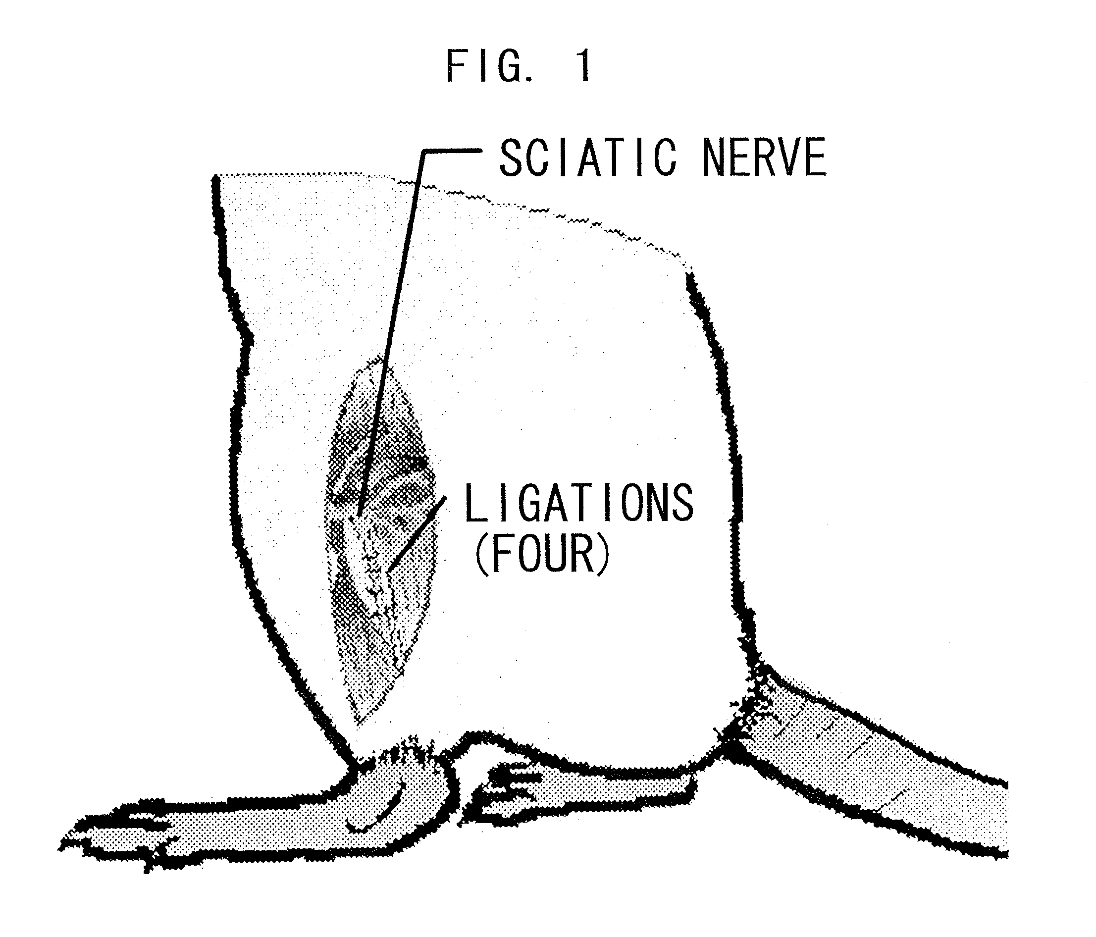 Therapeutic Agent for Sensory Abnormality