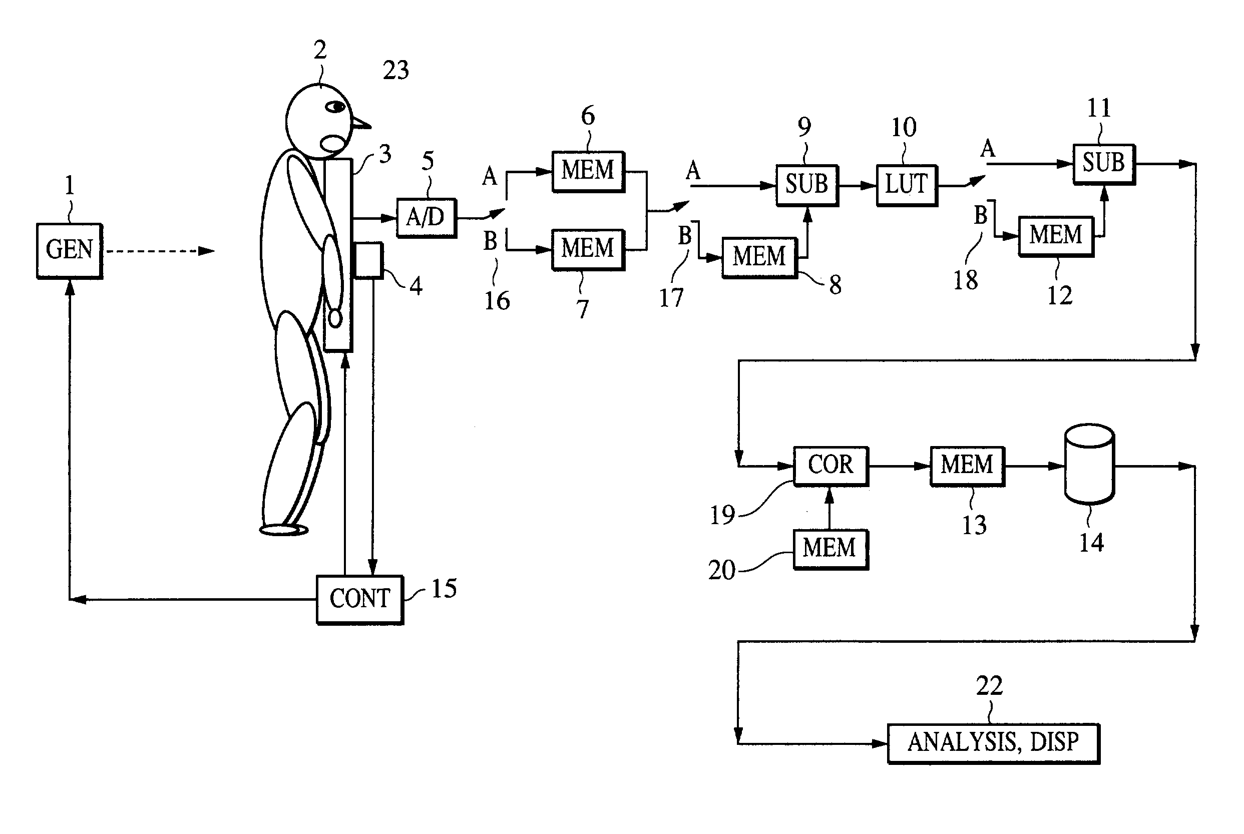 Radiographic image processing method, radiographic image processing apparatus, radiographic image processing system, program, computer-readable storage medium, image diagnosis assisting method, and image diagnosis assisting system