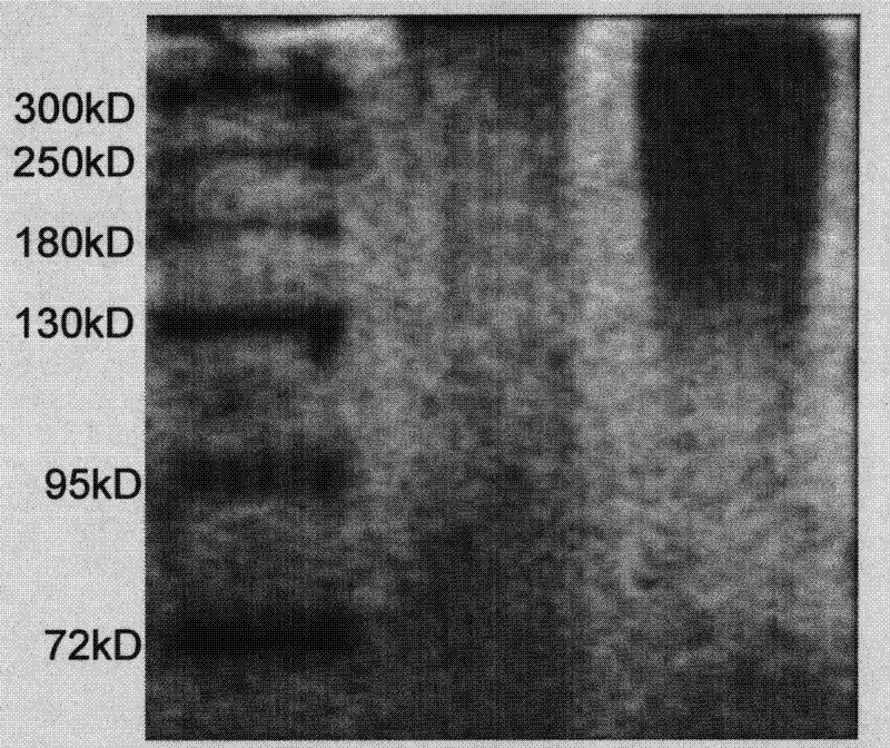 Bacteria YXY-C1 for preparing gamma-polyglutamic acid by solid fermentation and products thereof