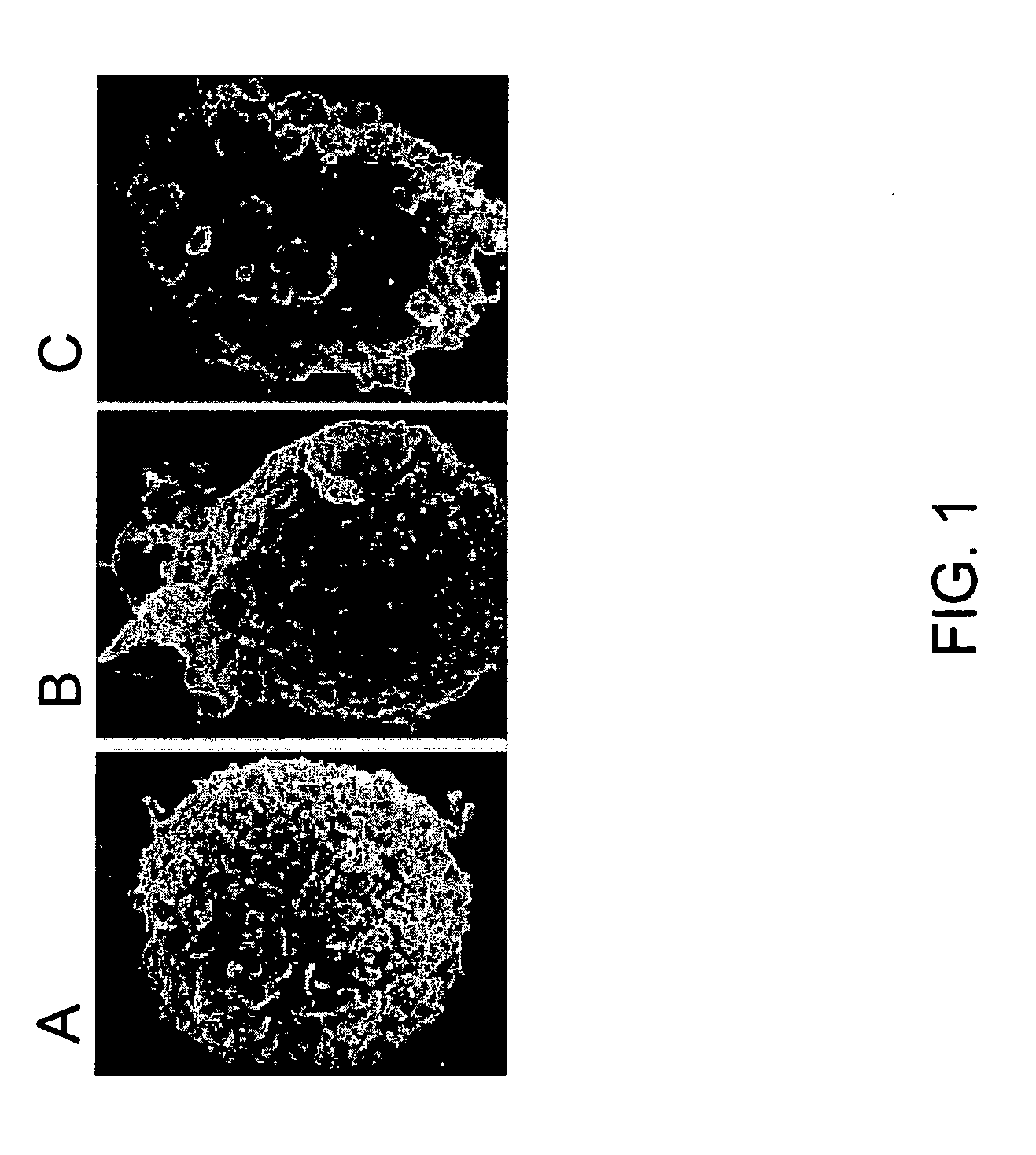 Methods for treating spinal cord injury with a compound that inhibits a NC<sub>Ca-ATP </sub>channel