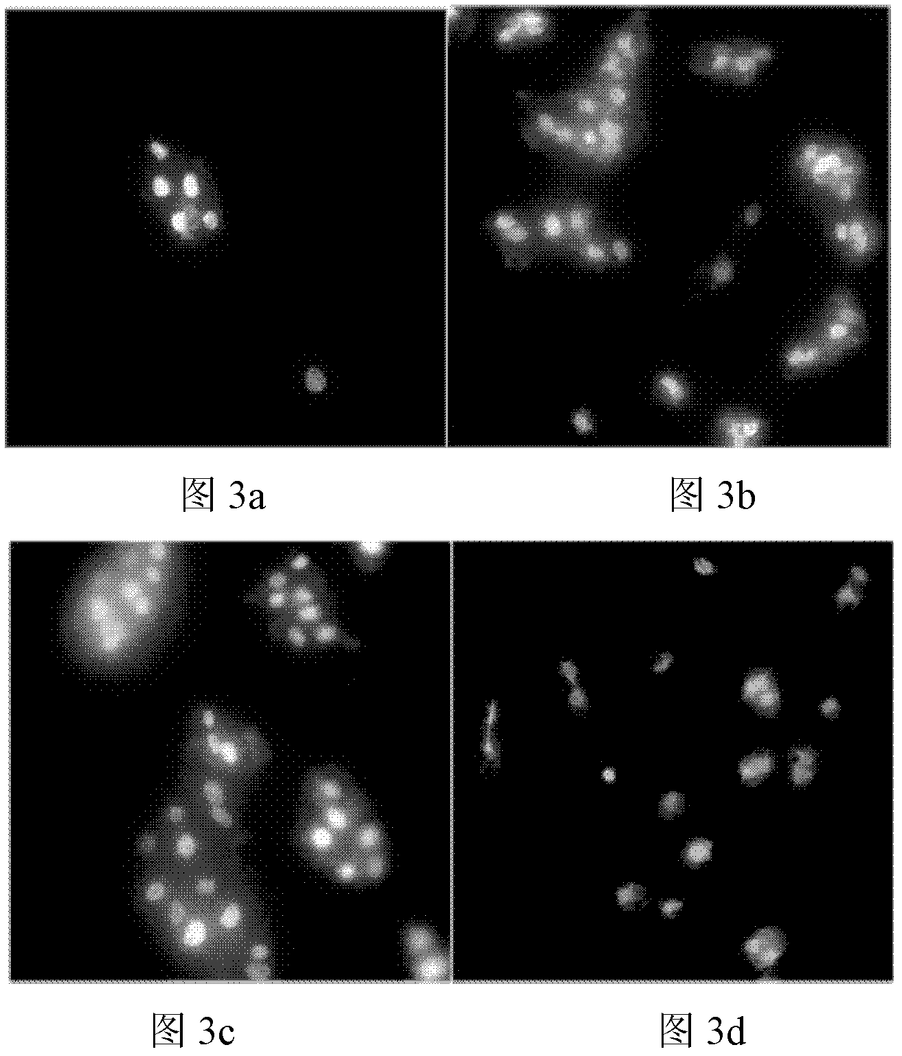 Dialysis membrane material having physiological function and preparation method thereof