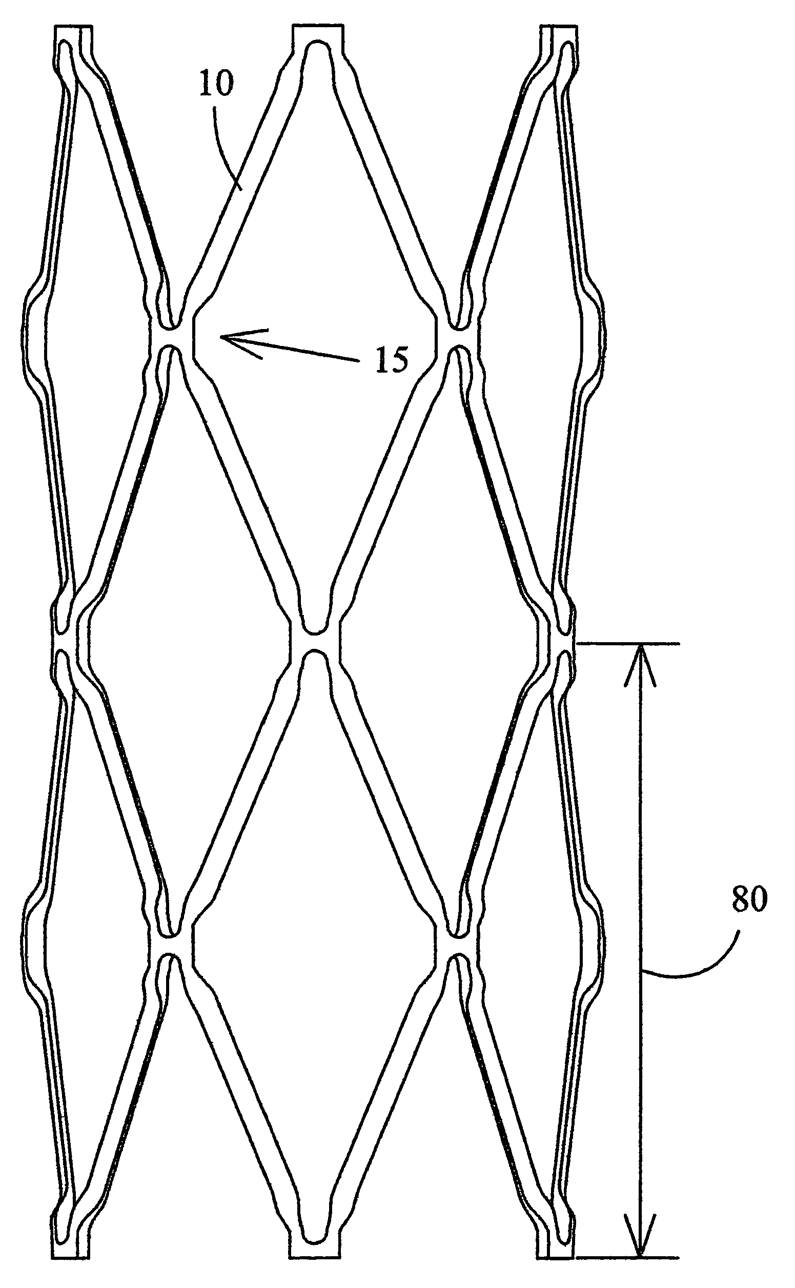 Intravascular hinge stent