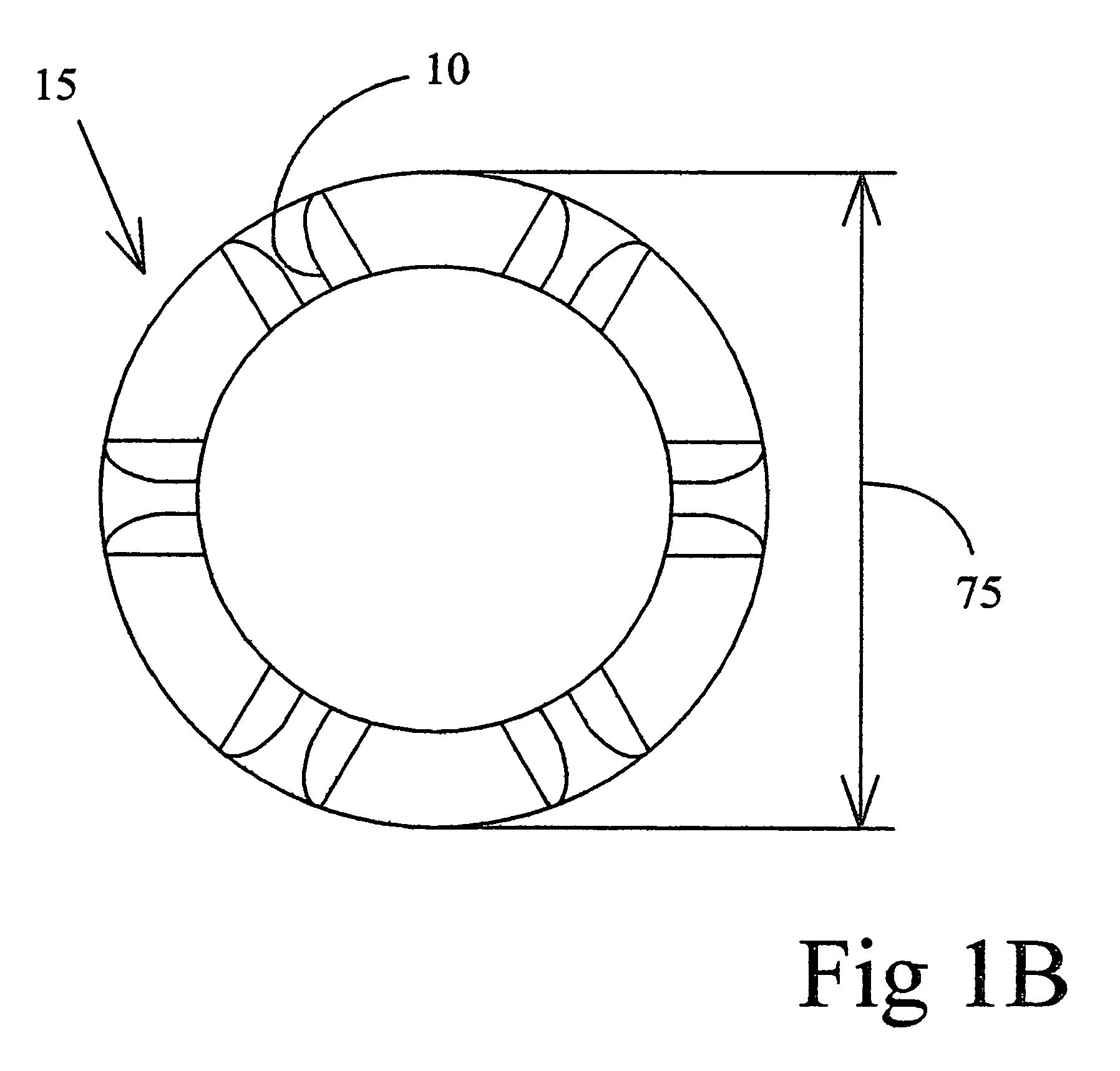 Intravascular hinge stent