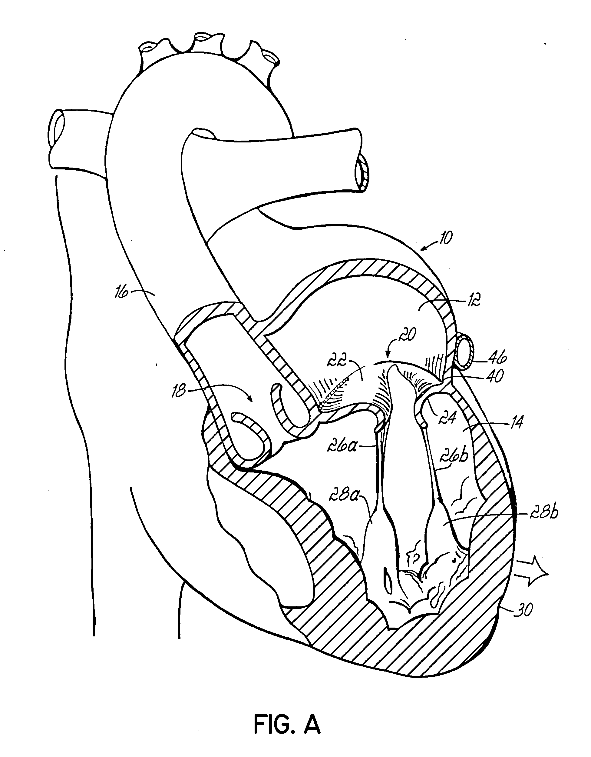 Tissue fastening systems and methods utilizing magnetic guidance