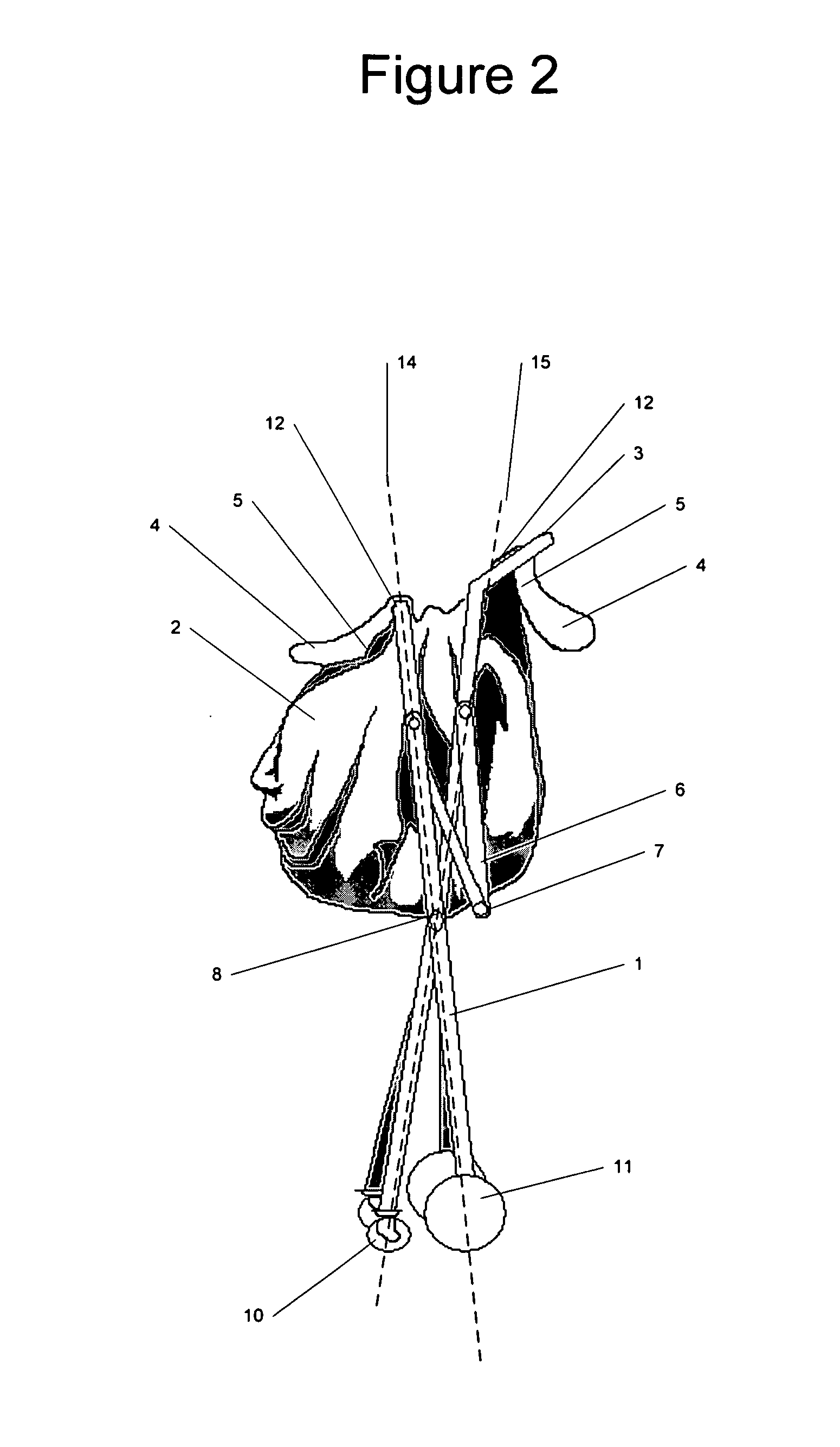 System combining a foldable wheeled cart and removable cloth bag