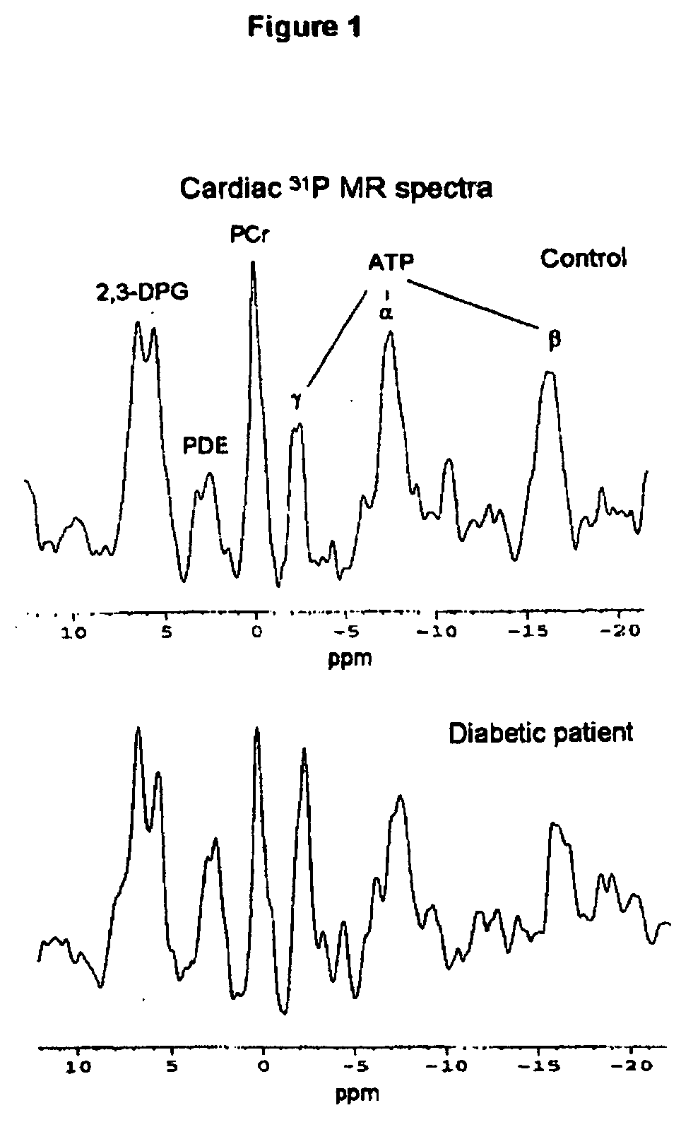 Treatment of muscle fatigue