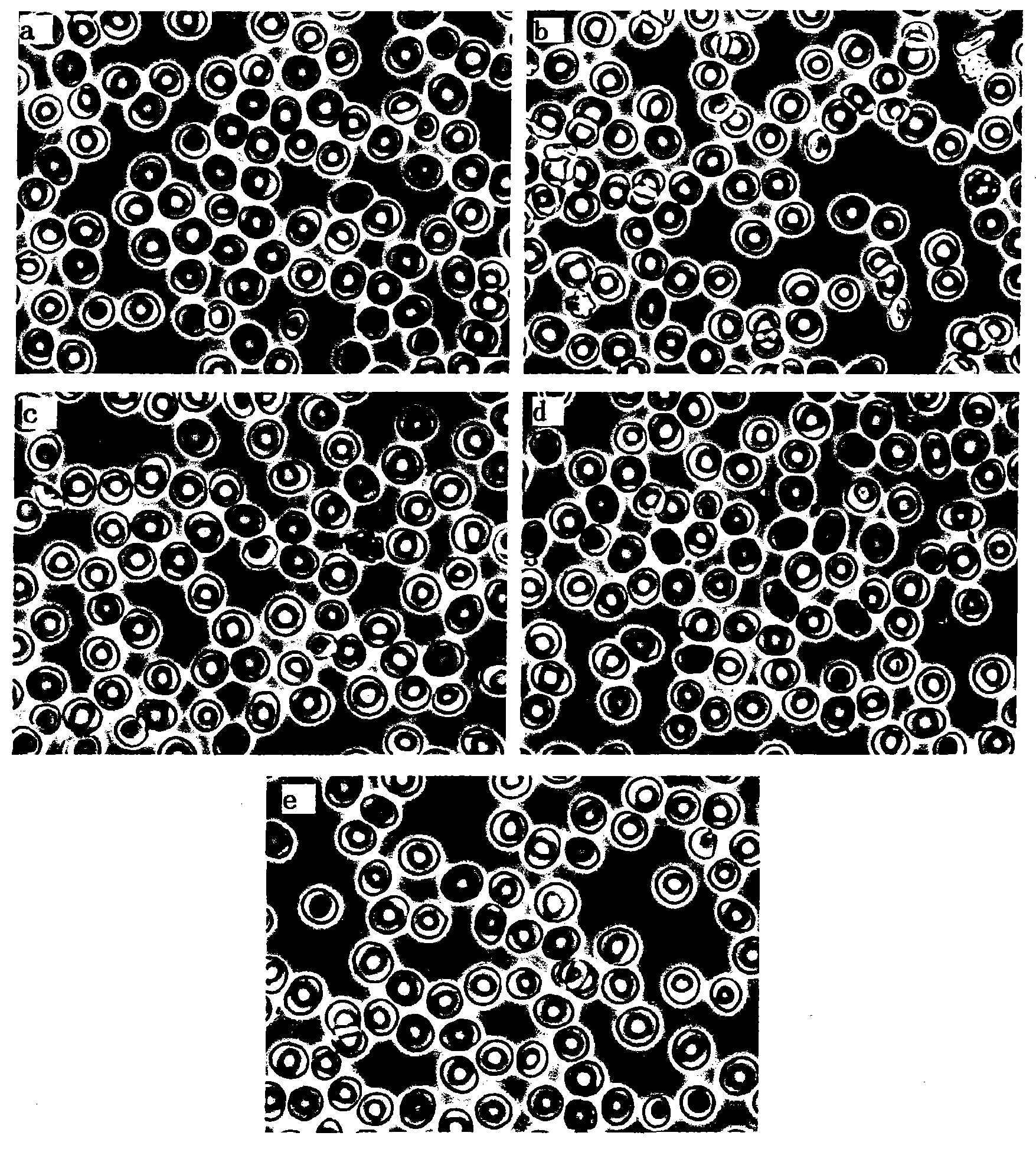 Biological technique method for recovering structure and function of erythrocyte