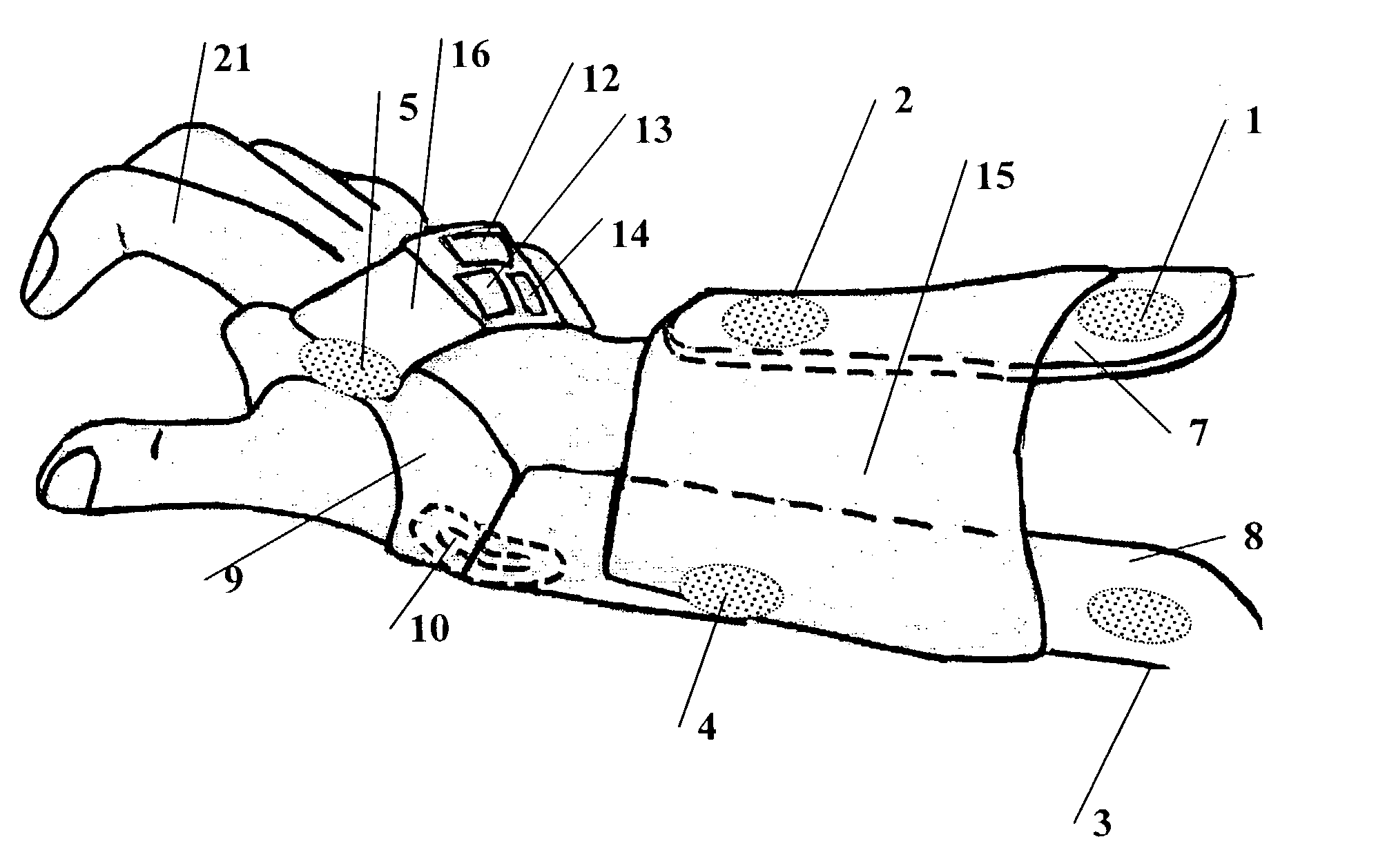 Functional electrical stimulation system