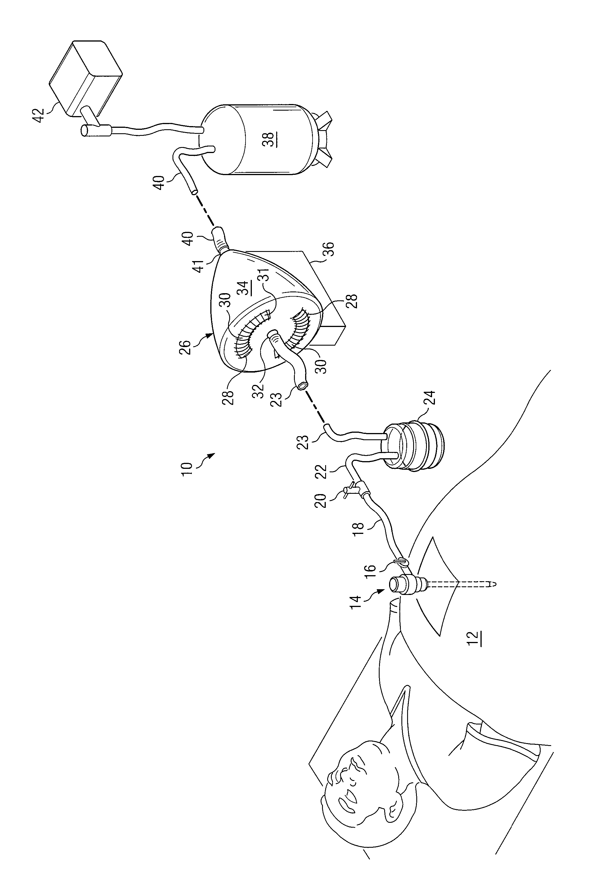 System and method to vent gas from a body cavity