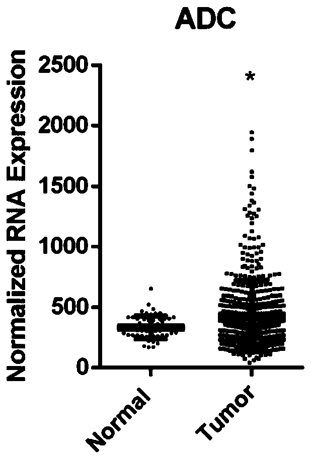 Application of long-chain non-coding RNA LINC00263 in preparation of adenocarcinoma-of-lung prognosis detection preparation