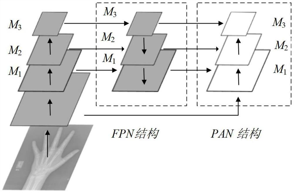 Bone age assessment method based on fine-grained classification