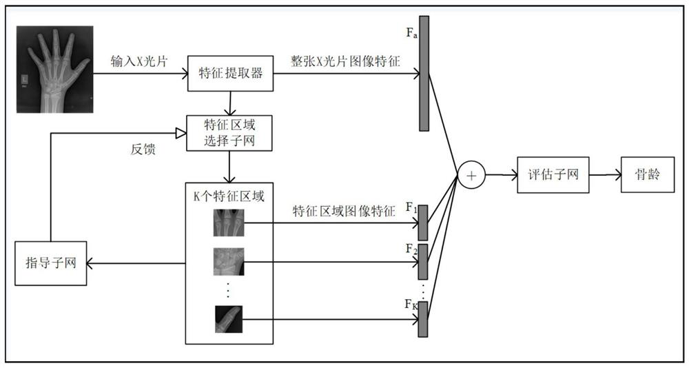 Bone age assessment method based on fine-grained classification