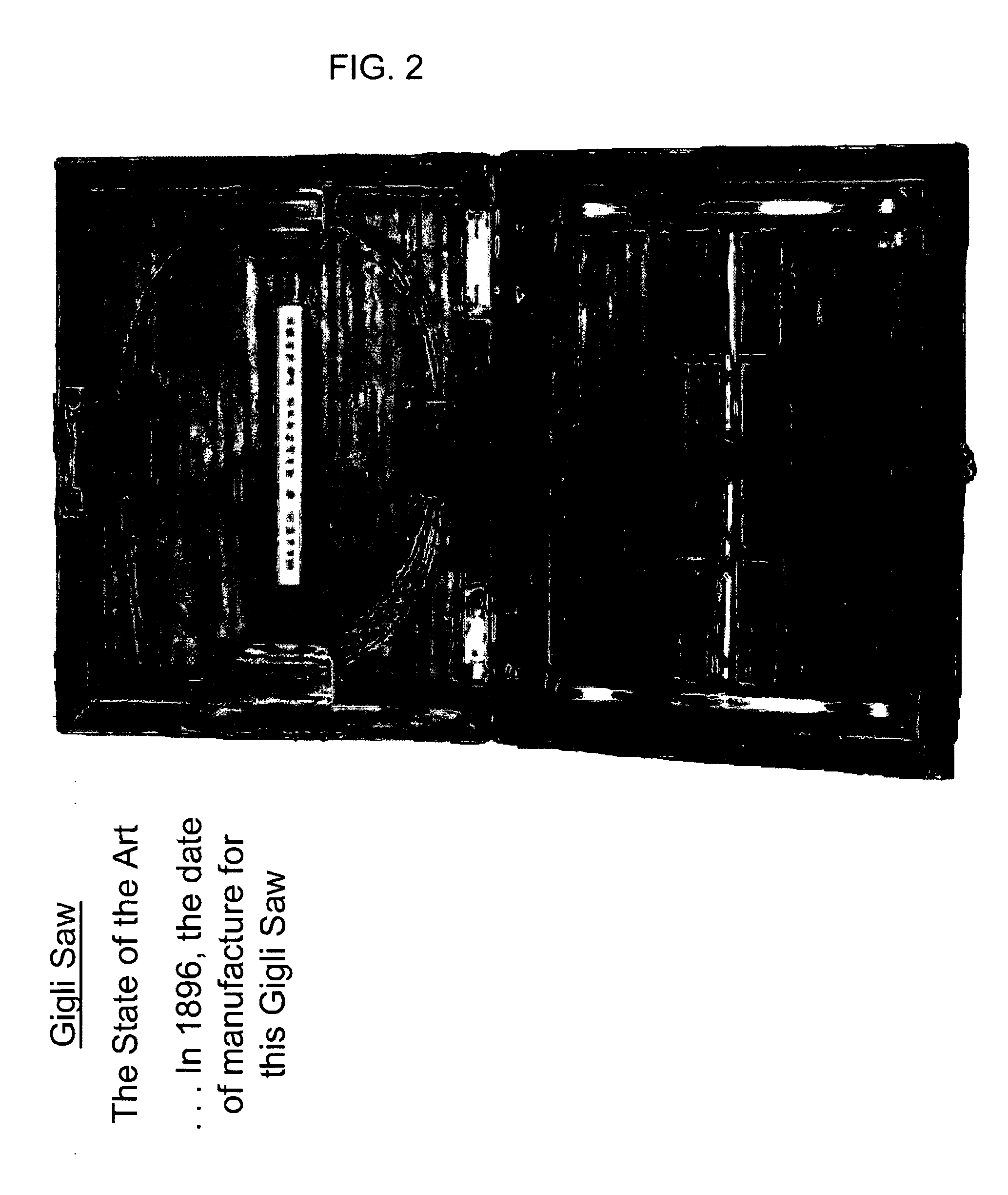 Methods and apparatus for wireplasty bone resection