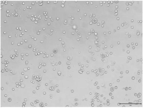 Lung cancer solid tumor primary cell culture method