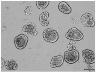 Lung cancer solid tumor primary cell culture method