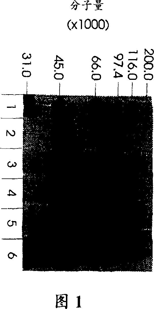 Use of hyaluronidase in the manufacture of an ophthalmic preparation for liquefying vitreous humor in the treatment of eye disorders