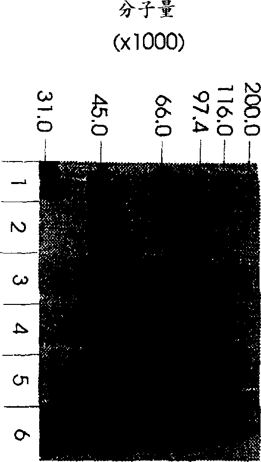 Use of hyaluronidase in the manufacture of an ophthalmic preparation for liquefying vitreous humor in the treatment of eye disorders