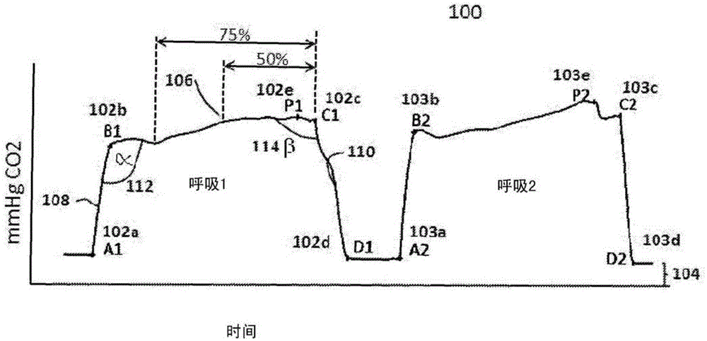 Capnography system for automatic diagnosis of patient condition