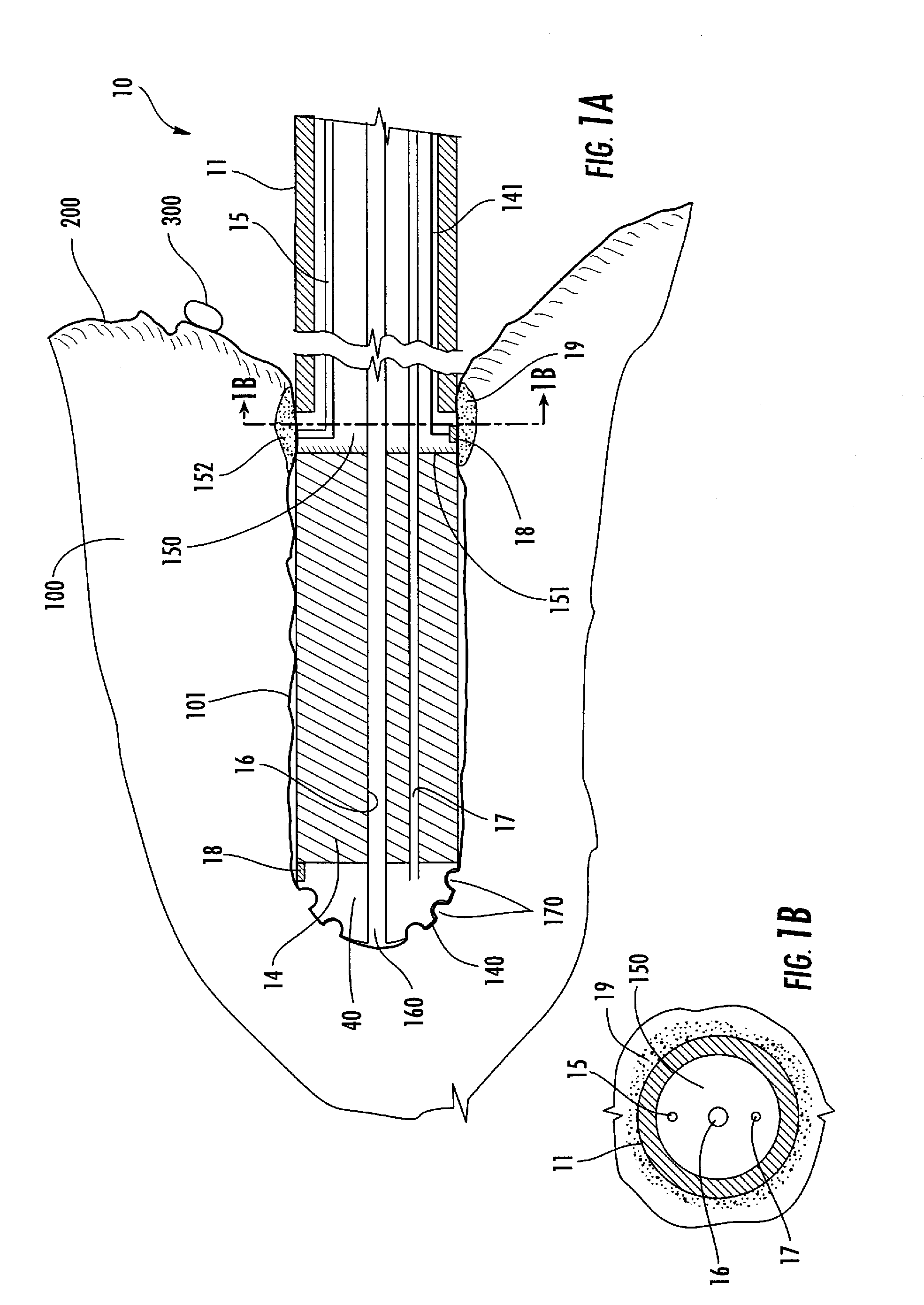 Fluid flowing device and method for tissue diagnosis or therapy