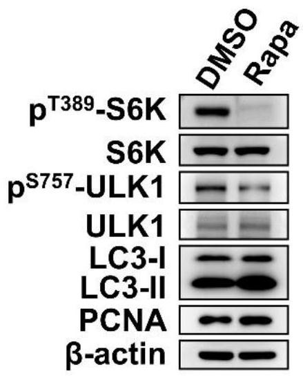 Application of rapamycin in promotion of neural stem cell amplification