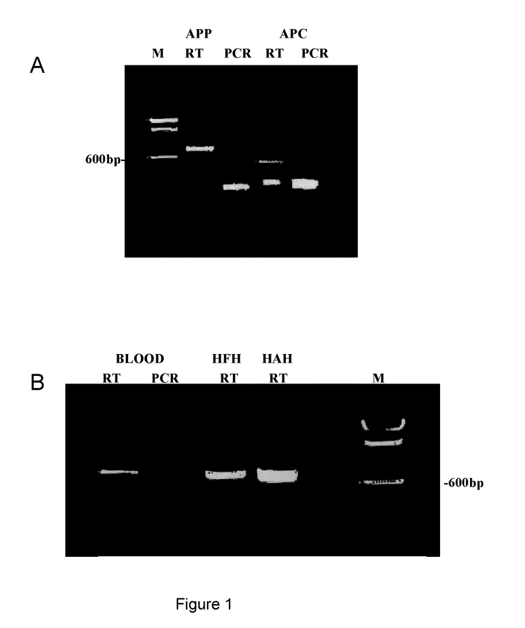 Method for the detection of gene transcripts in blood and uses thereof