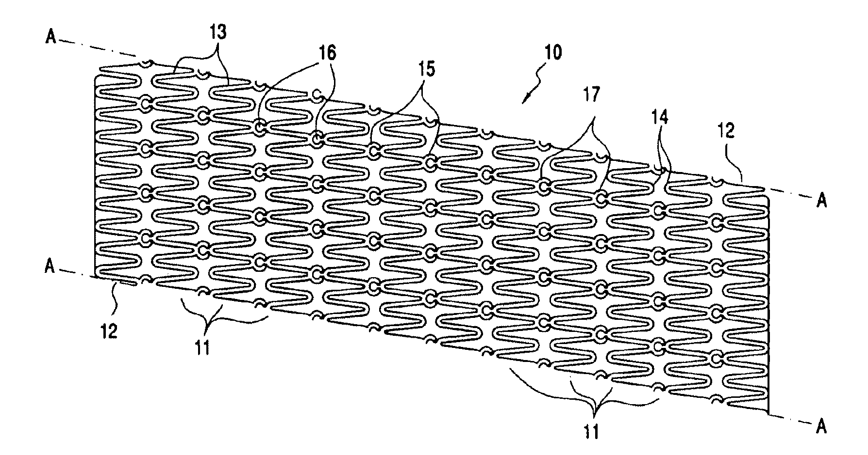 Modular vascular prosthesis and methods of use