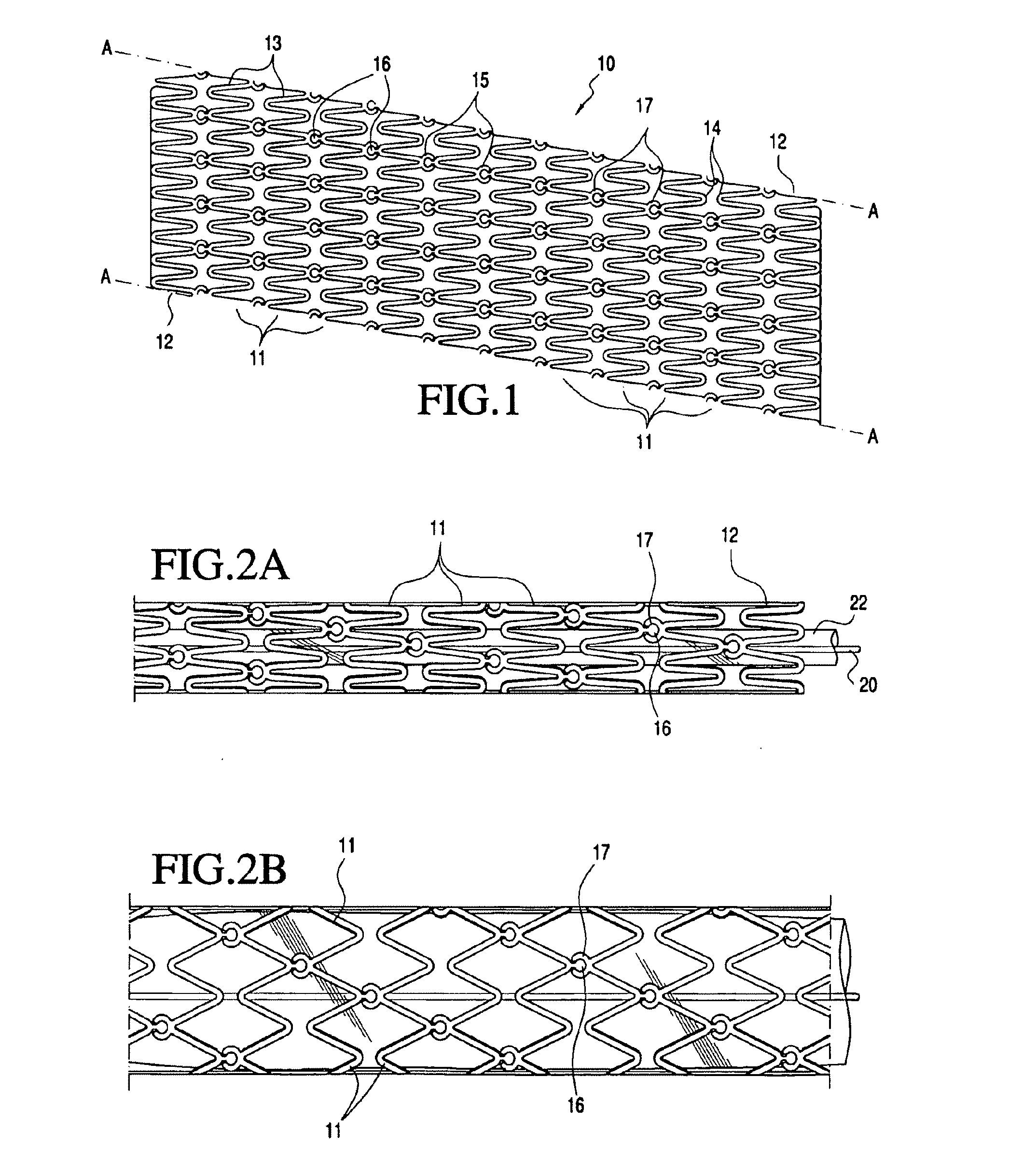 Modular vascular prosthesis and methods of use