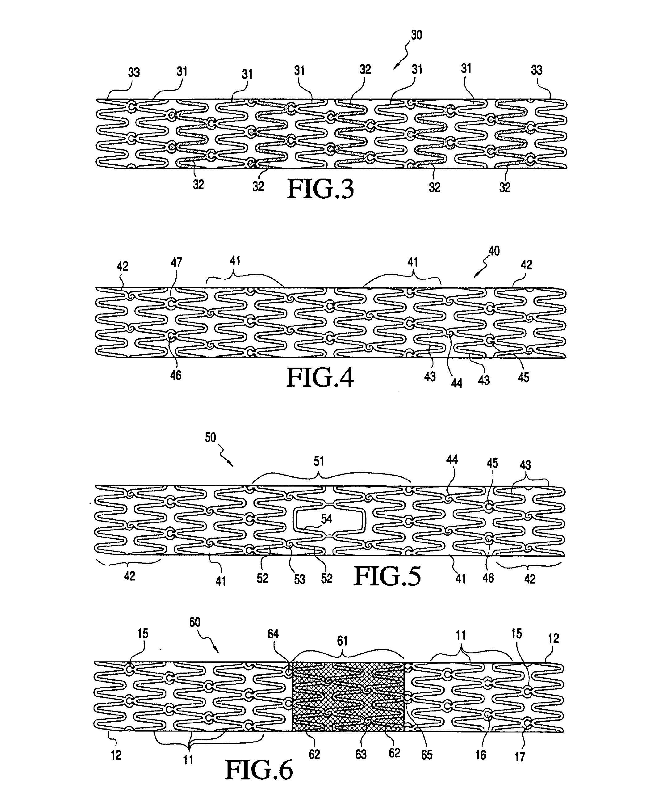 Modular vascular prosthesis and methods of use