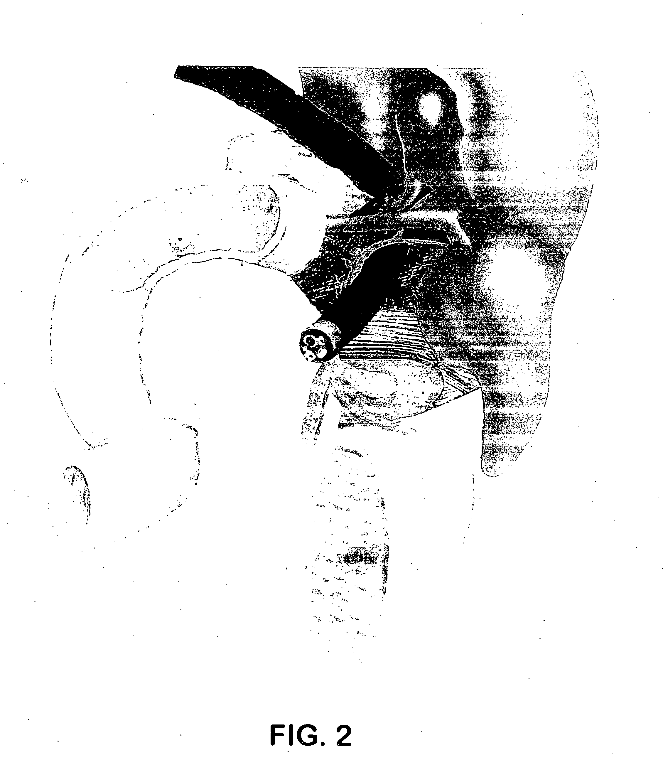 Method and kit for biopsying of pancreatic tumor masses