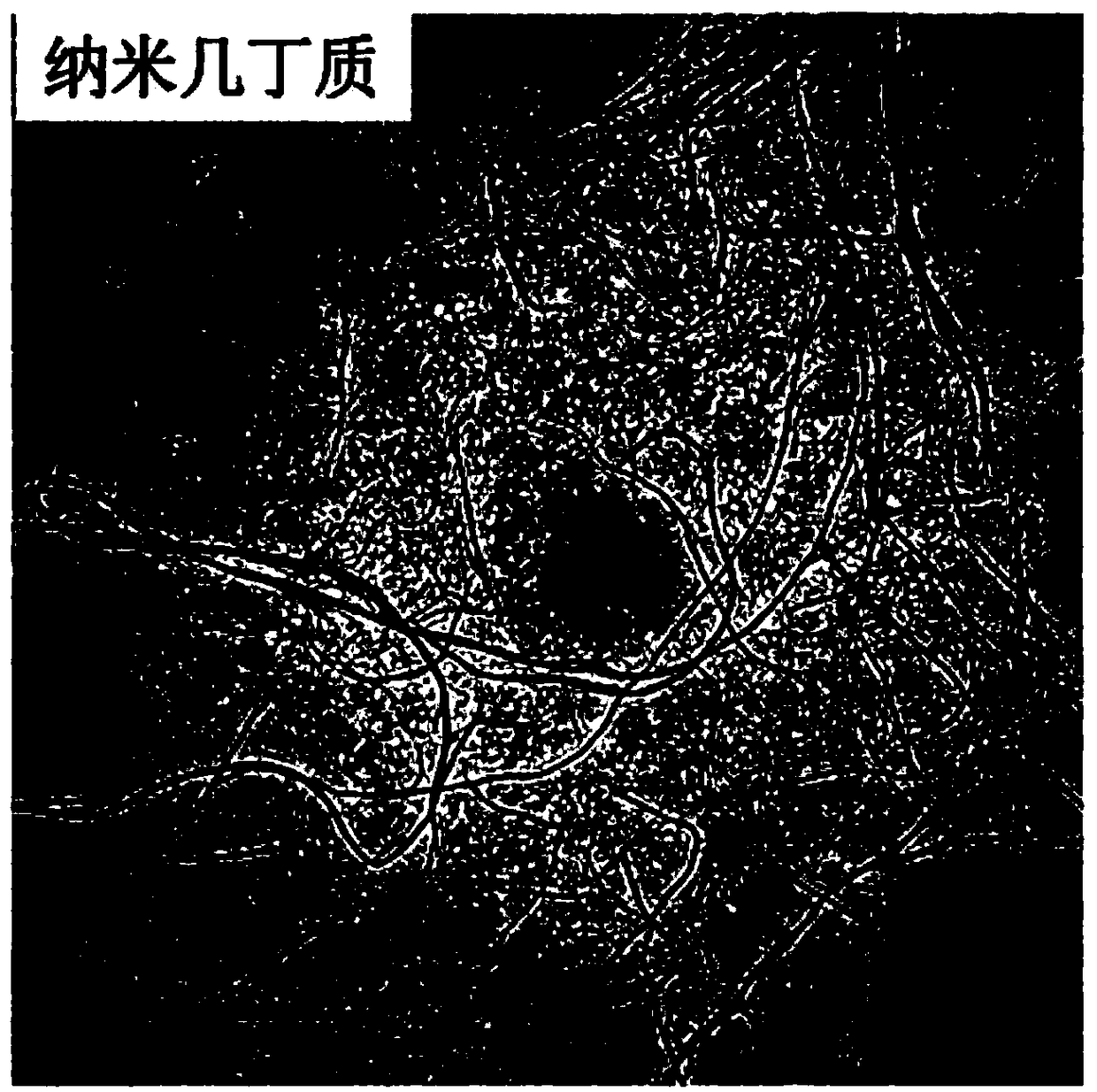 Nano chitin hydrogel and aerogel and preparation method and application thereof