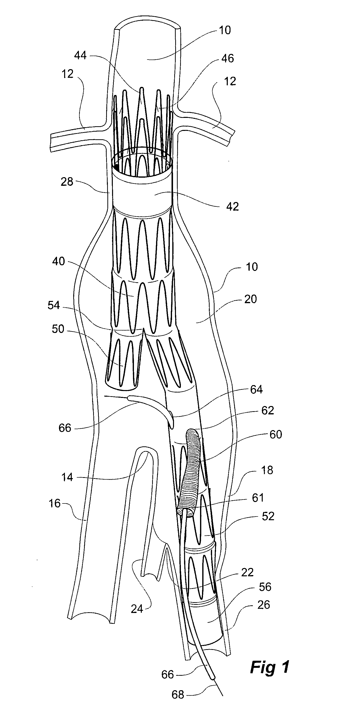 Twin bifurcated stent graft