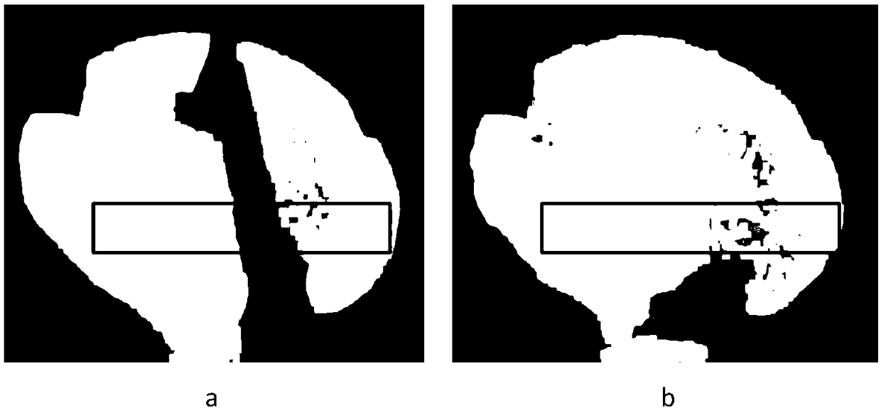 An intelligent slag removing method of molten iron based on machine vision